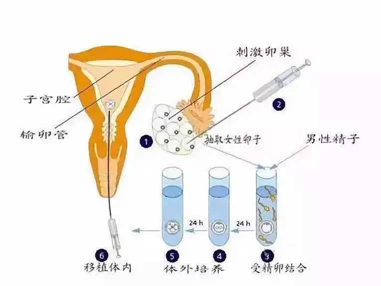 <b>孕期反应大是男孩还是女孩</b>